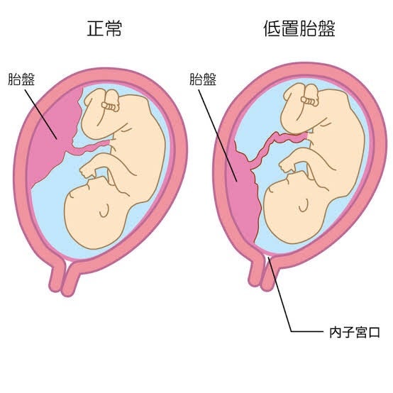 さいたま市 産後骨盤矯正 女性 整体 矯正 接骨院 最寄り:土呂 宮原 東大宮 東宮原 加茂宮 上尾 駐車場あり ベルアピア ホットペッパー